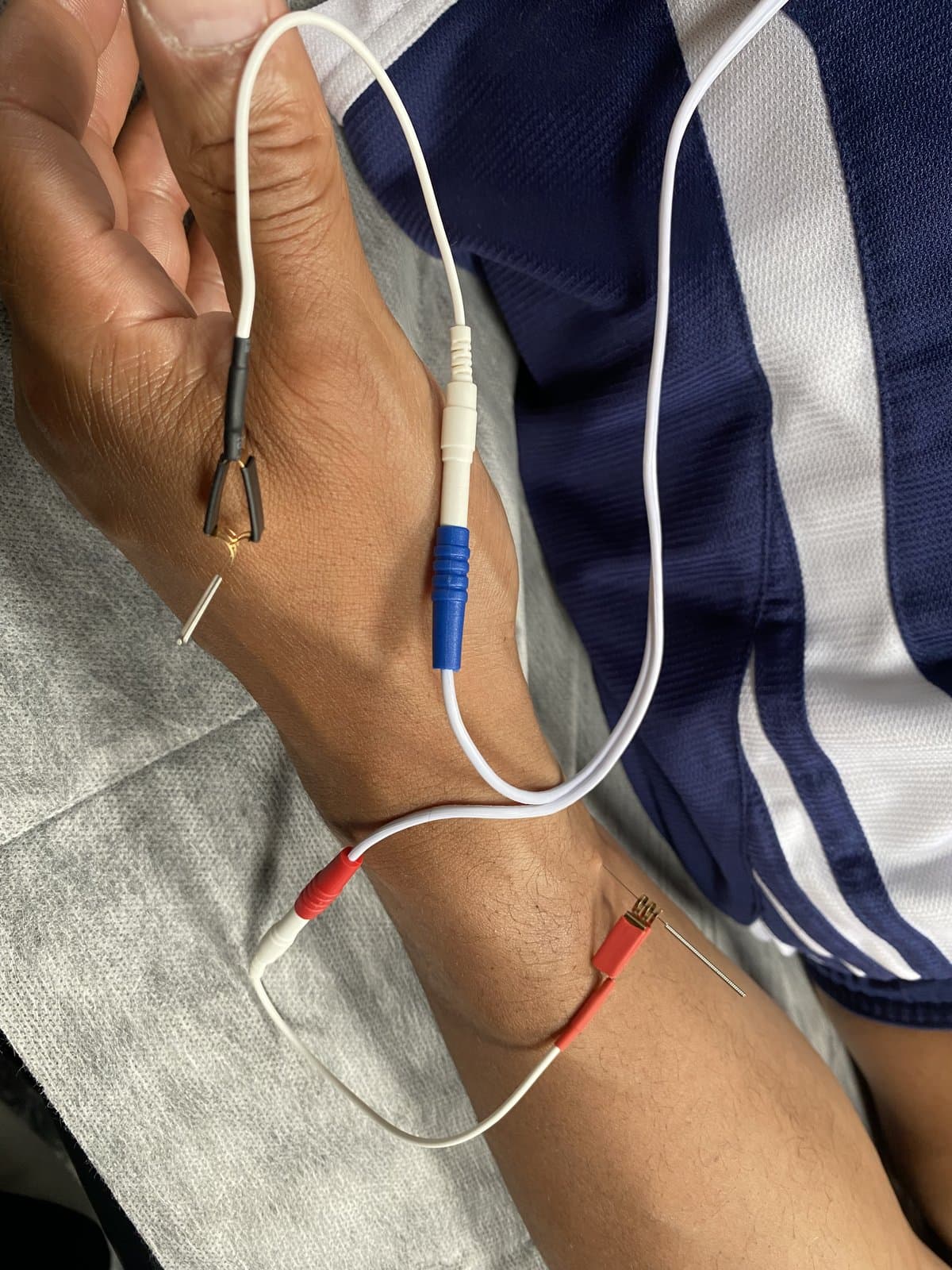 Blood Electrification Treatment (BET) electrodes in place during a session